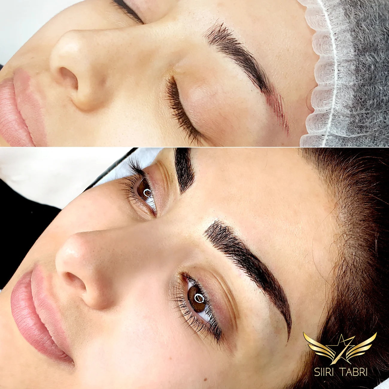 SharpBrows Light microblading. Sometimes you just have to fix old and quite strange pigmentation/microblading. Light microblading is ideal for that.