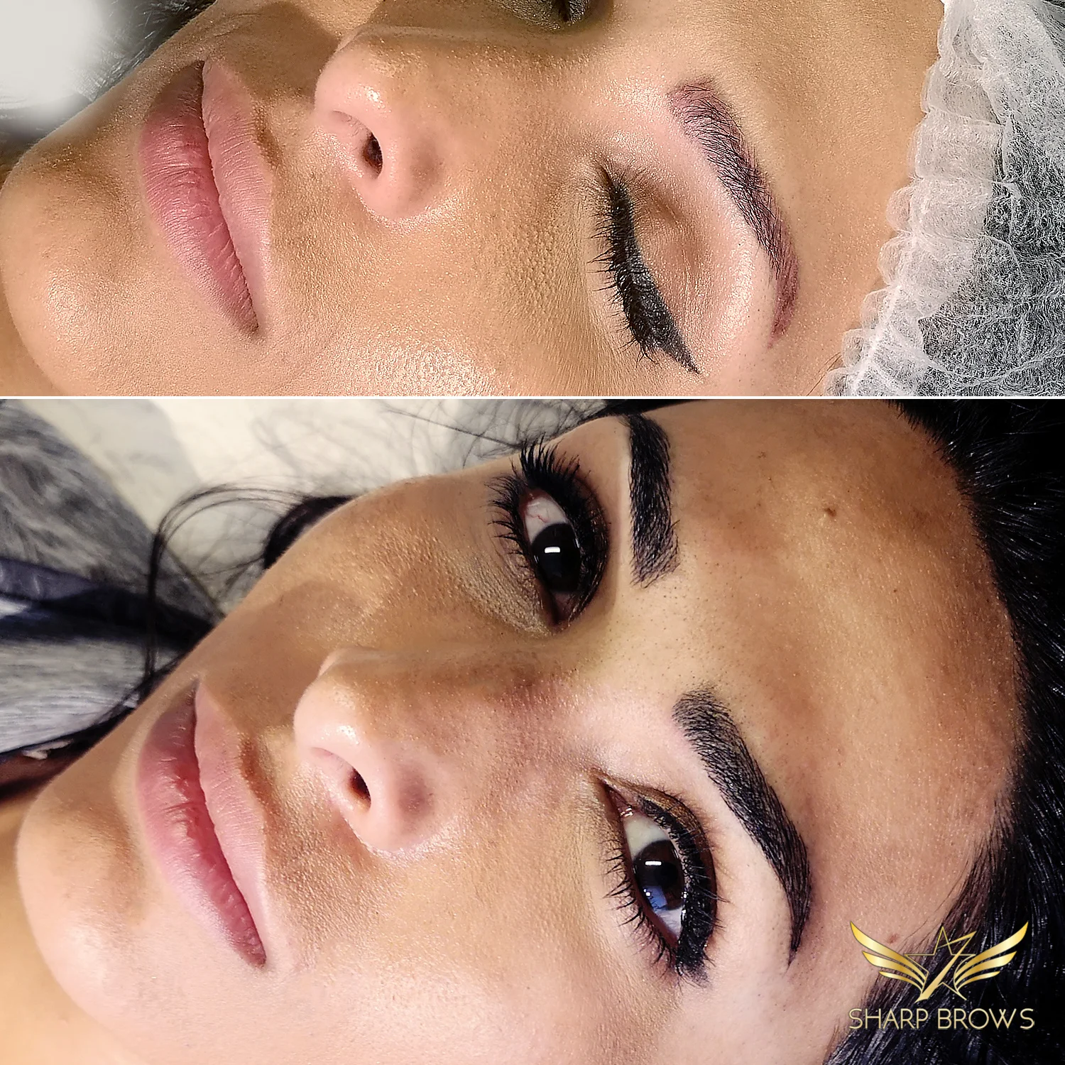 Light microblading - Pretty typical situation where an old pigmentation or tattoo has been turned into a beautiful Light microblading brow.
