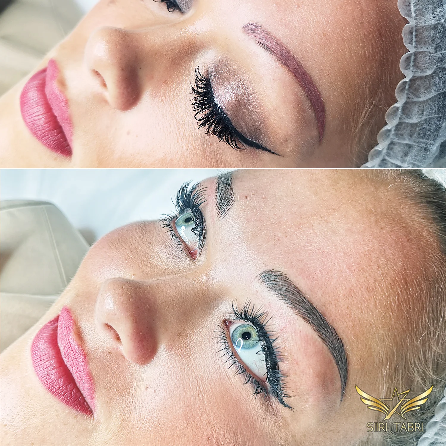 Light microblading. Very often the starting situation is really challenging. With Light microblading even quite strong pigmentation can be made to look natural.