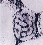 Pigment Cell -&nbsp;Melanocyte    