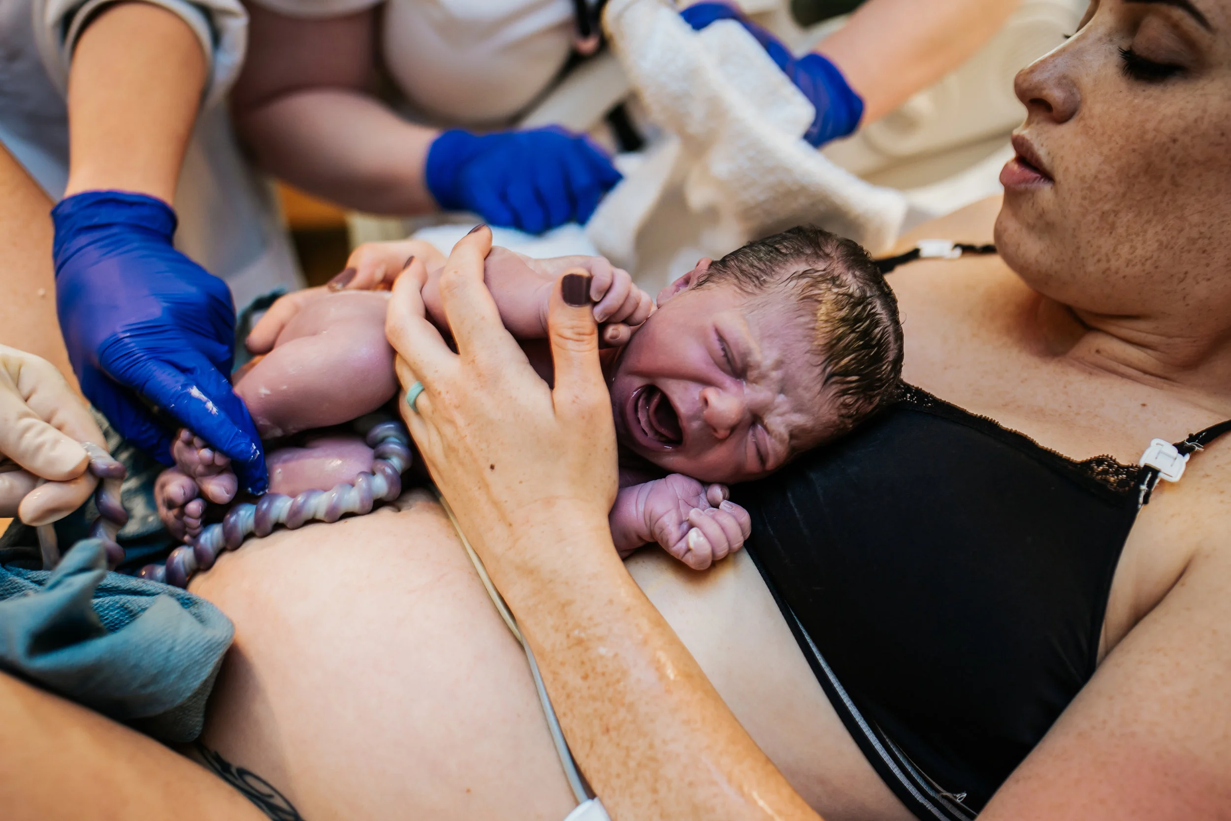 Can we all just take a moment to look at this beautiful pulsing blue cord? Birth with Dr Graham at Sacred Heart on the Emerald Coast.