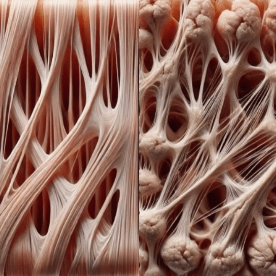 Your Fascia Is Thirsty: Why Hydration Matters More Than You Think