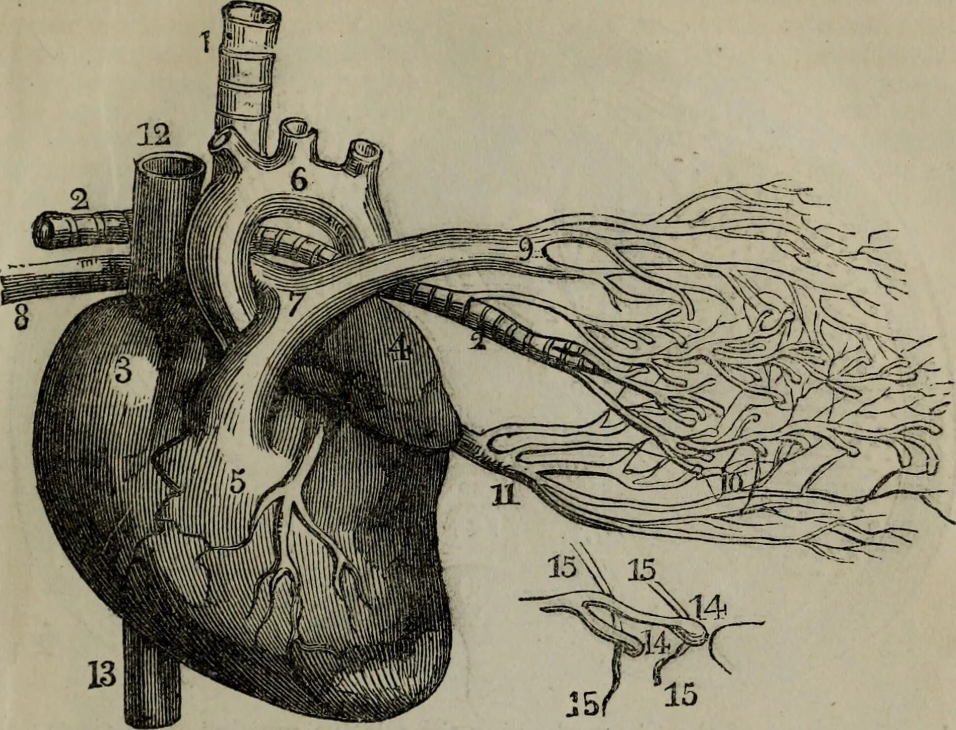 Obscuring the Heart's Condition