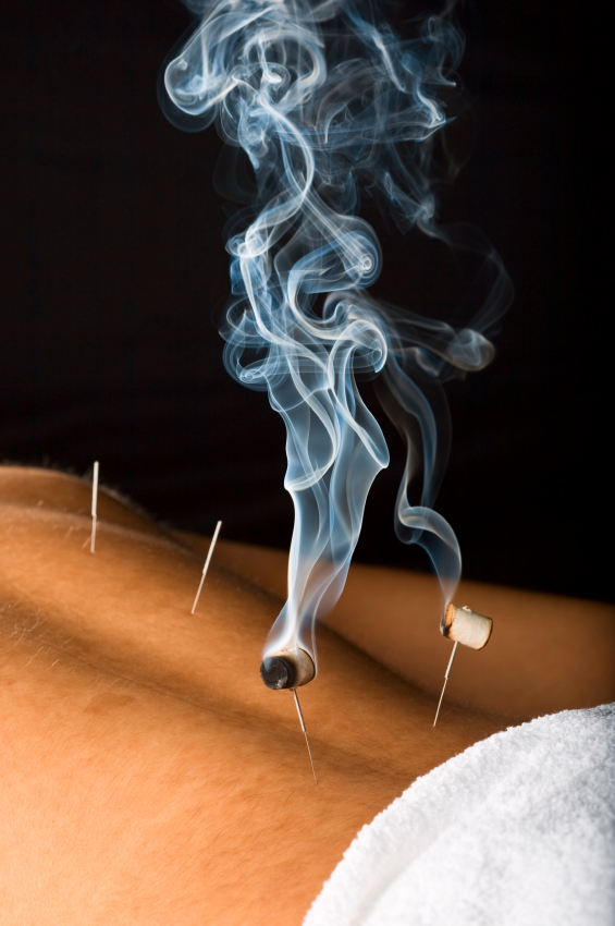 moxibustion.jpg