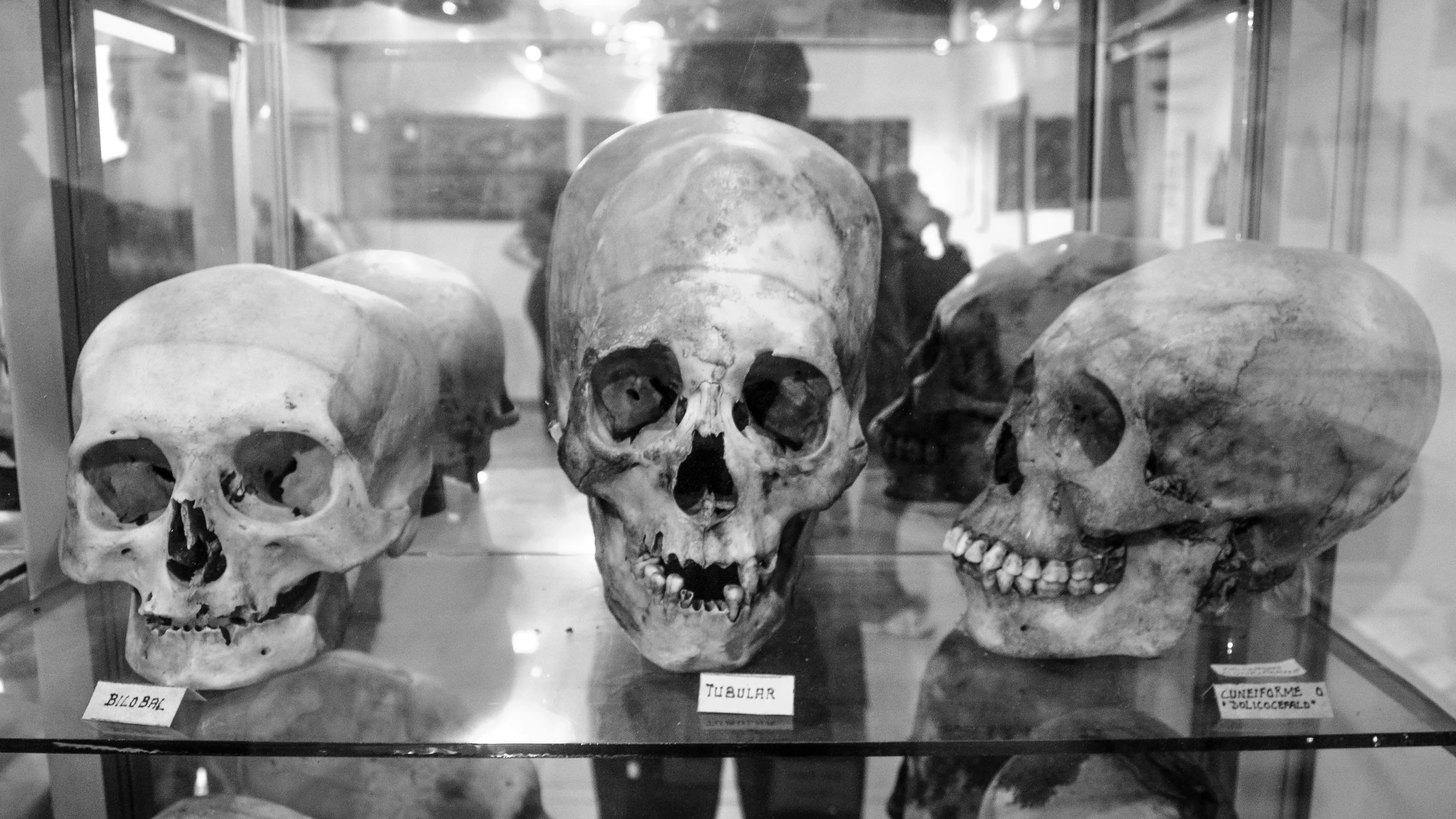 The Paracas culture were believed to treat psychological disorders and physical trauma through bloodletting which required drilling holes in the skull.