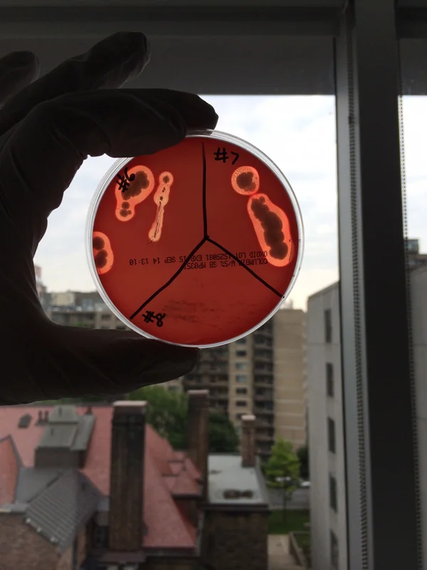 ANTIBIOTIC-PRODUCING ISOLATES FROM SOIL ON BLOOD AGAR