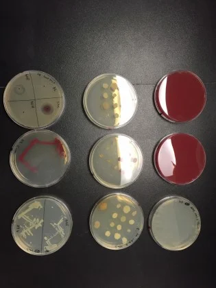 NINE OF KRISTEN BURNHAM'S PETRI DISHES. THE TWO DISHES ON THE RIGHT ARE COVERED IN A DEEP RED GROWTH OF V. RUBER . THE DISH ON THE UPPER LEFT IS DIVIDED INTO QUADRANTS TO TEST FOUR DIFFERENT TYPES OF BACTERIA FOR ANTIBIOTIC ACTIVITY. THE FUZZY HAZE COVERING MOST OF THE DISH IS B. SUBTILLIS , A REFERENCE SPECIES. V. RUBER , ON THE LOWER RIGHT QUADRANT OF THIS DISH, IS SURROUNDED BY A CLEAR AREA WHERE NO B. SUBTILIS WILL GROW, EVIDENCE OF V. RUBER 'S ANTIBIOTIC POWERS. (KIM KRIEGER/UCONN PHOTO)
