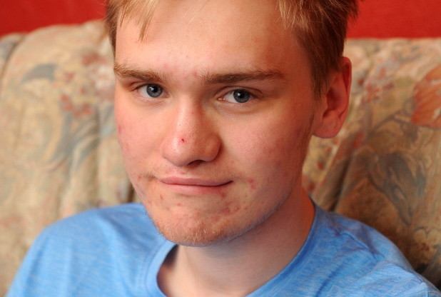 HELP: Jack Smith and his family are helping plastic surgery charity OPSA