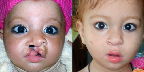 B&A3.jpg