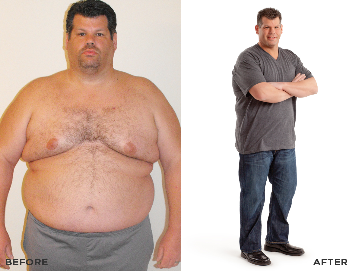 richard-r-before-after.jpg