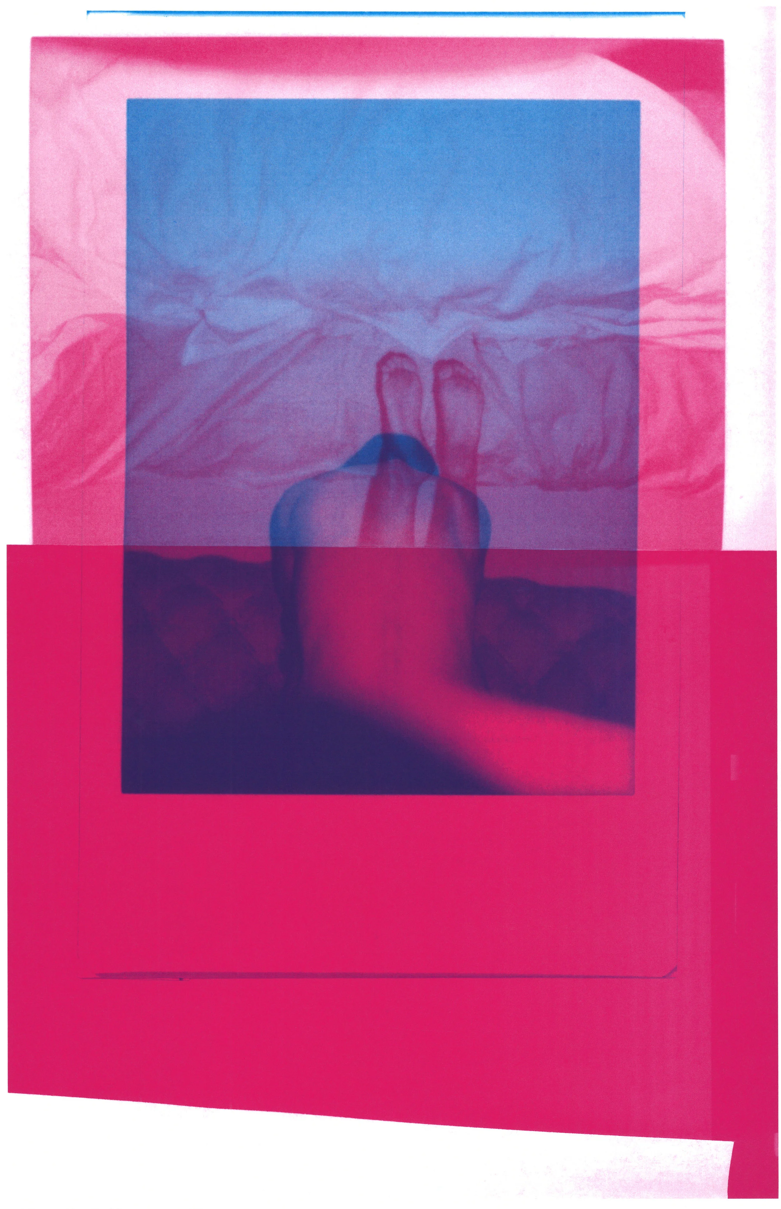 Tenderness and Dryness, 2018