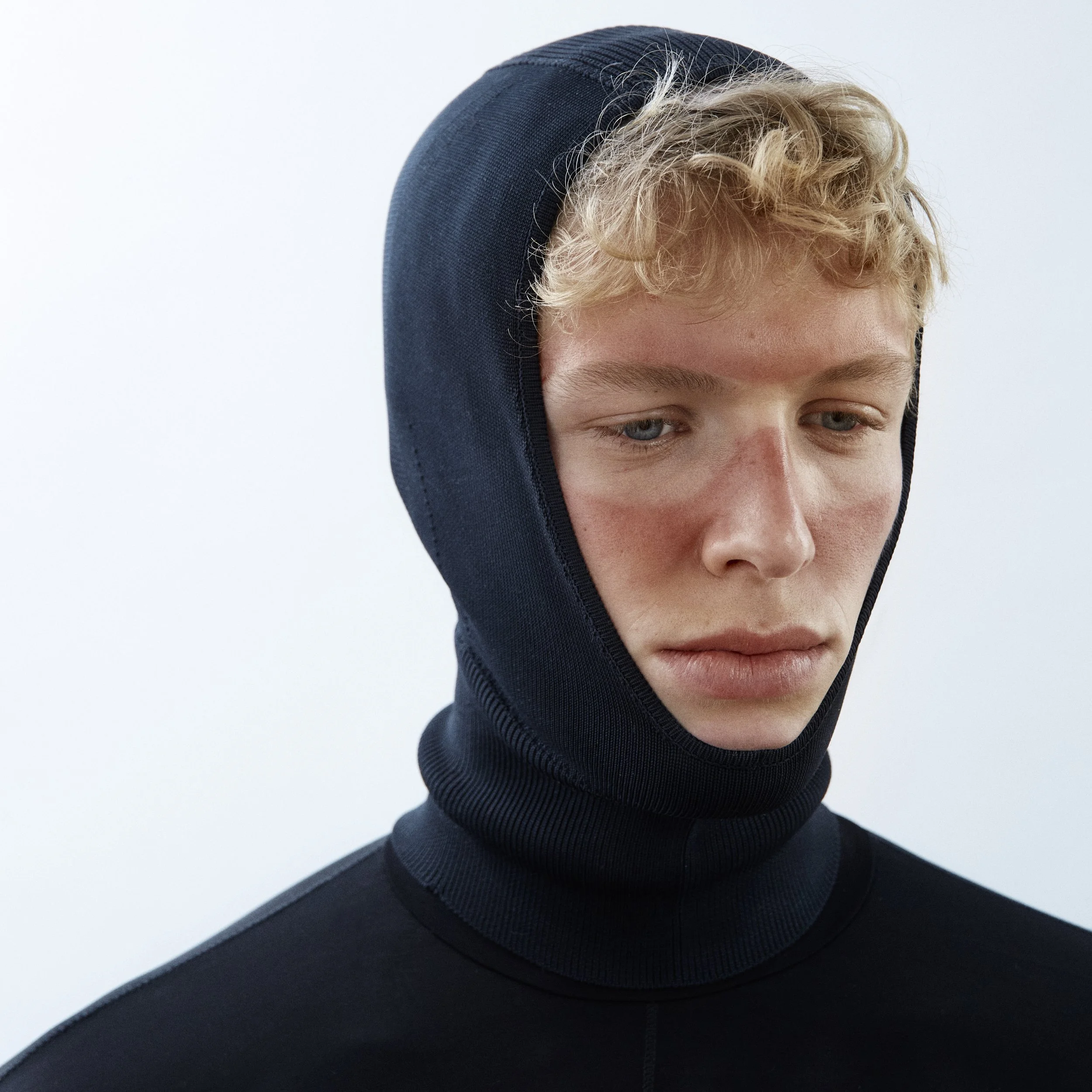 sunburn_15.0234892.jpg
