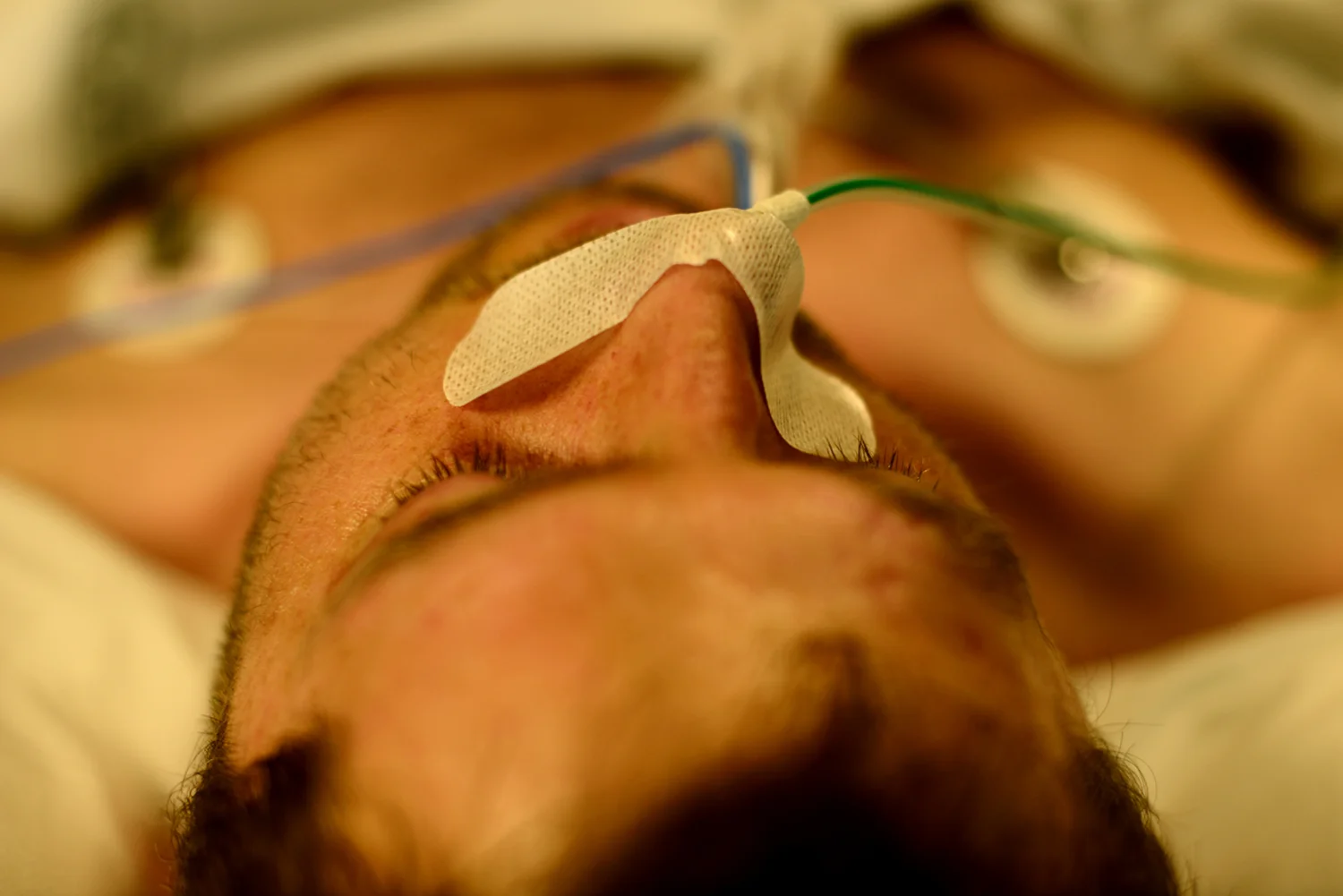 Matt hooked up to the intubator and other tubes.