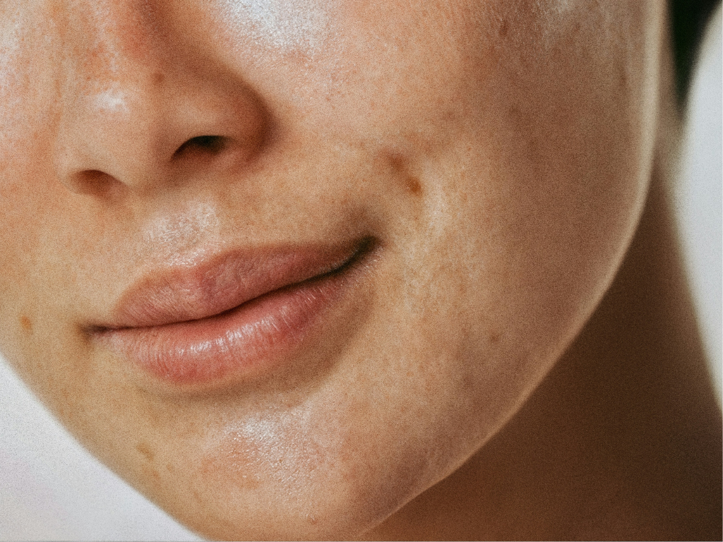 Reveal Peel Facial Kennebunk