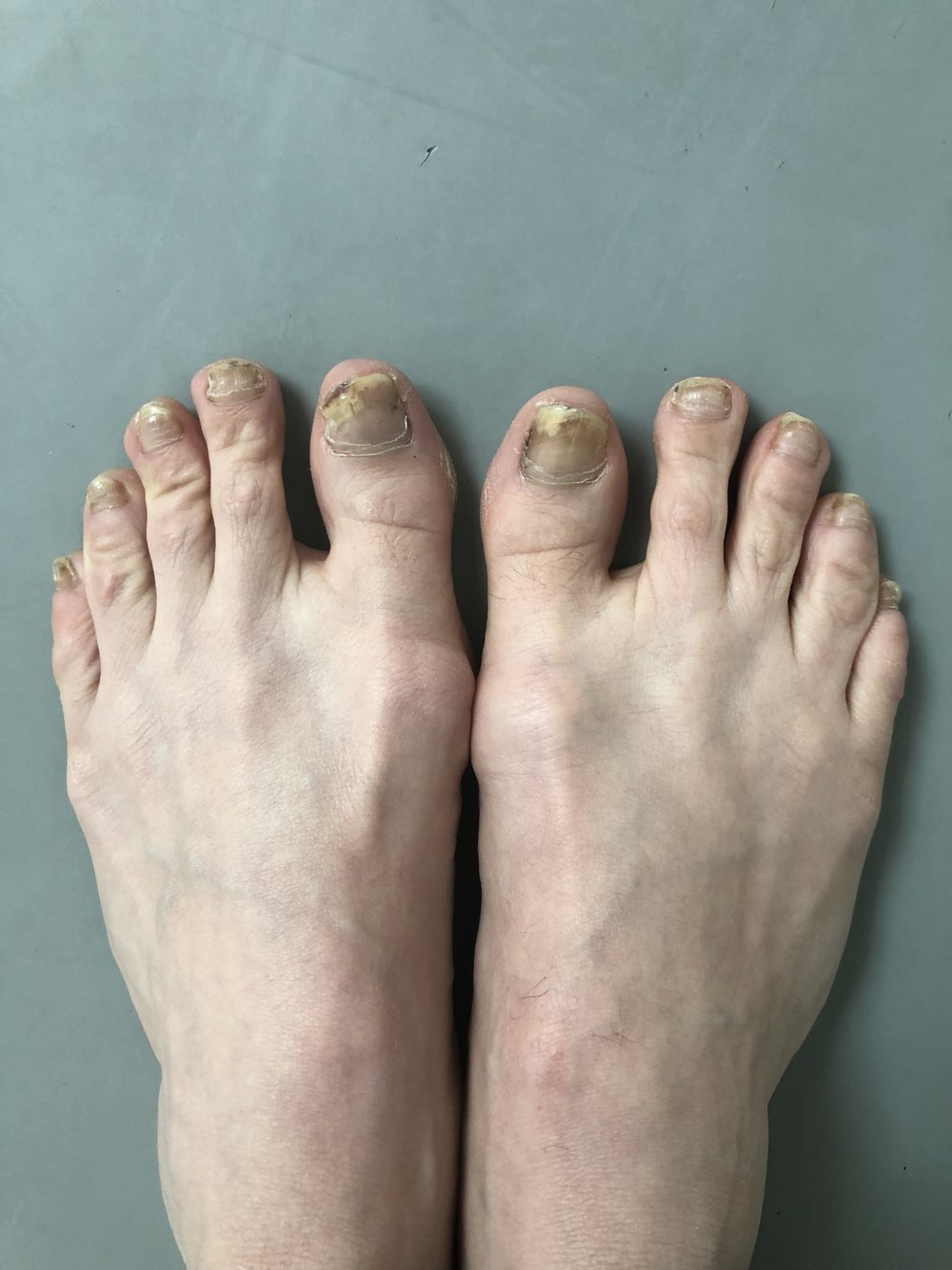 My Feet — Ballet Style