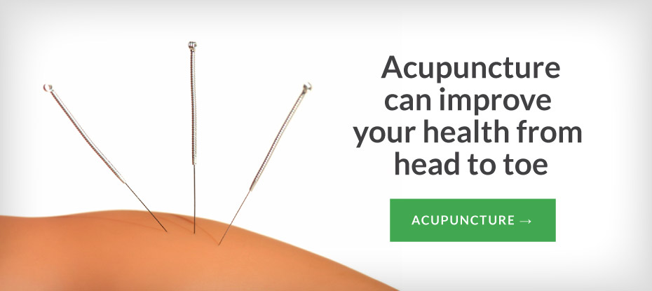 Acupuncture 