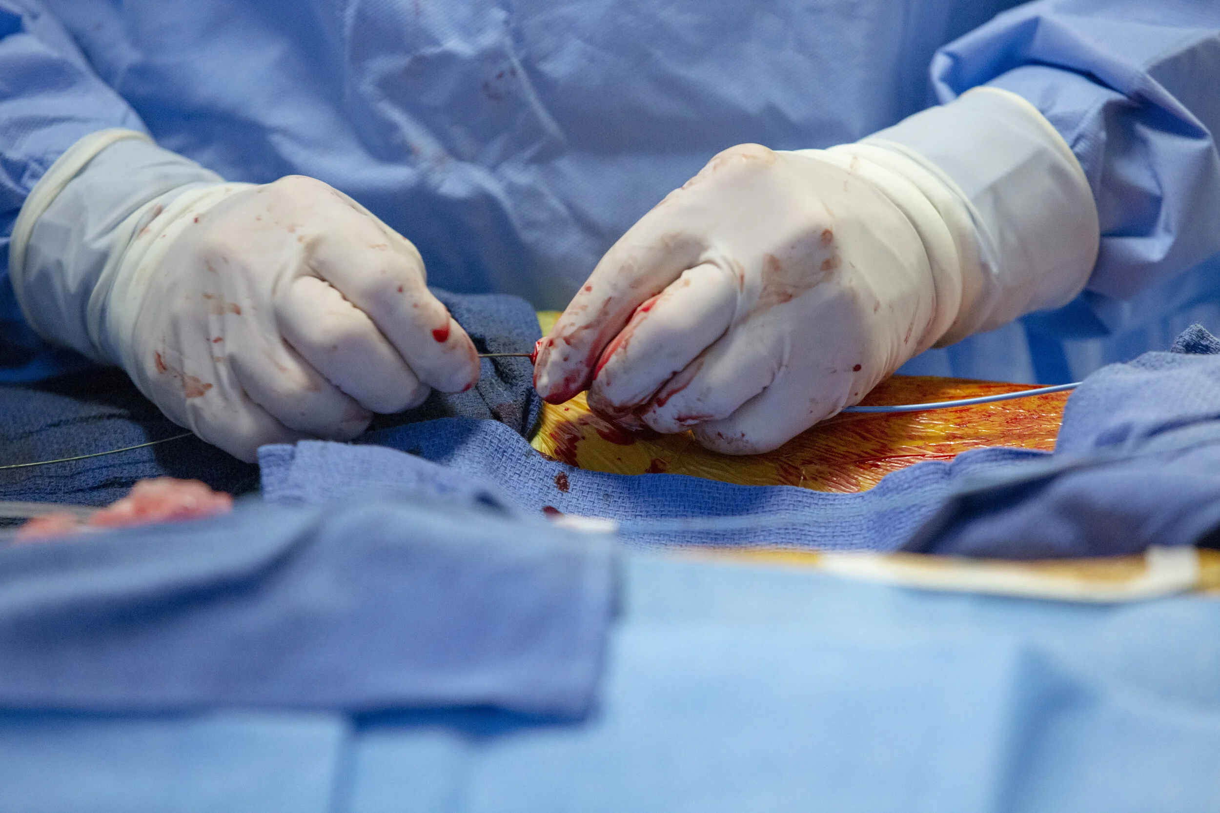 09192019-EdwardLotusSurgery-006492.jpg