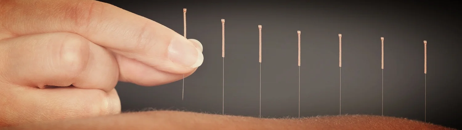 Acupuncture Main.jpg