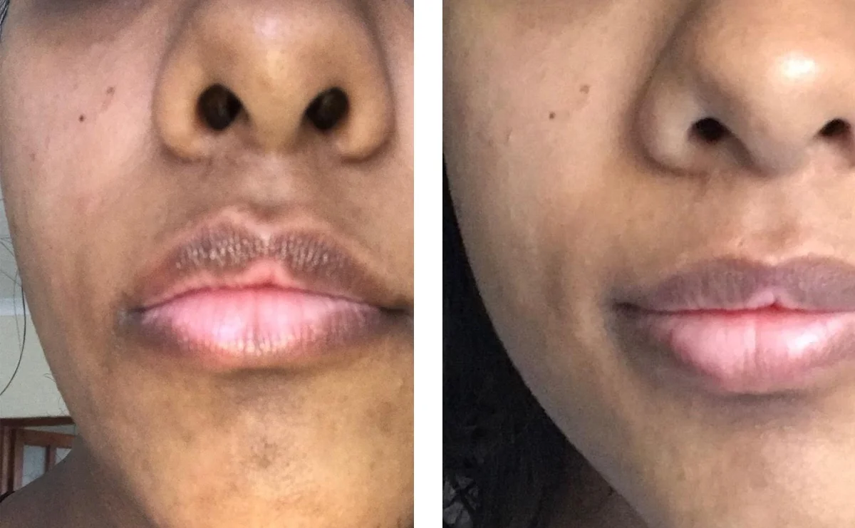 MicroBeforeAfter2.jpg