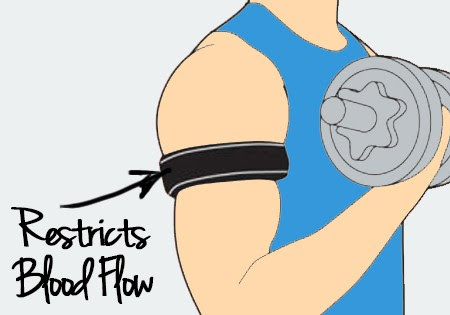 Blood Flow Restriction Training — Best Physical Therapy NYC
