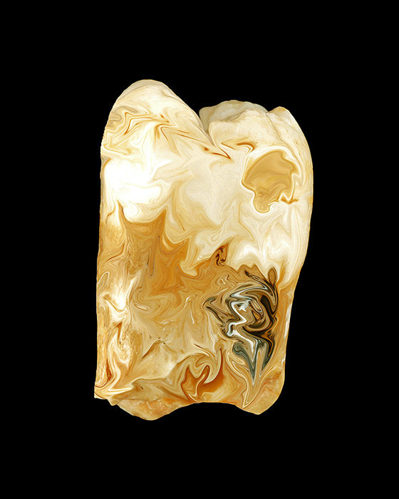K10 distal LUKA 3 .jpg