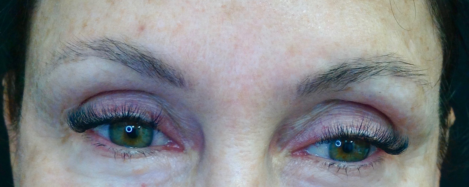 AFTER: One session of removal has lightened the pigment enough to re-design and recolor the brows in a more complimentary shape and color.