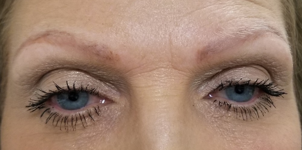 Before microblading