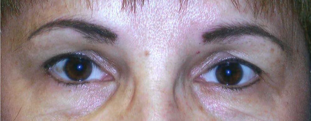 After brow and eyeliner
