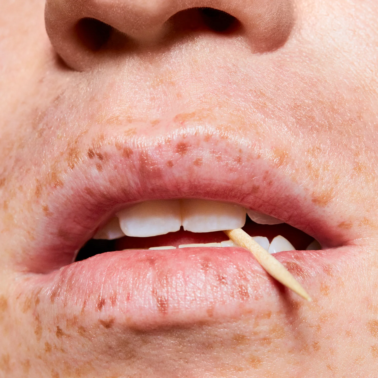 COMITA_170510_MLE_GiveMeLip_06-Freckles-108_B-web.jpg