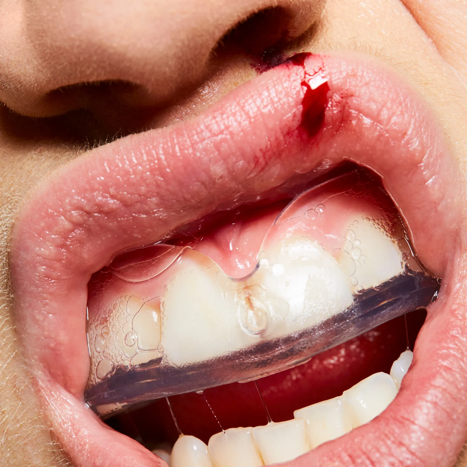 COMITA_170510_MLE_GiveMeLip_12-BustedLip-007_A-web.jpg