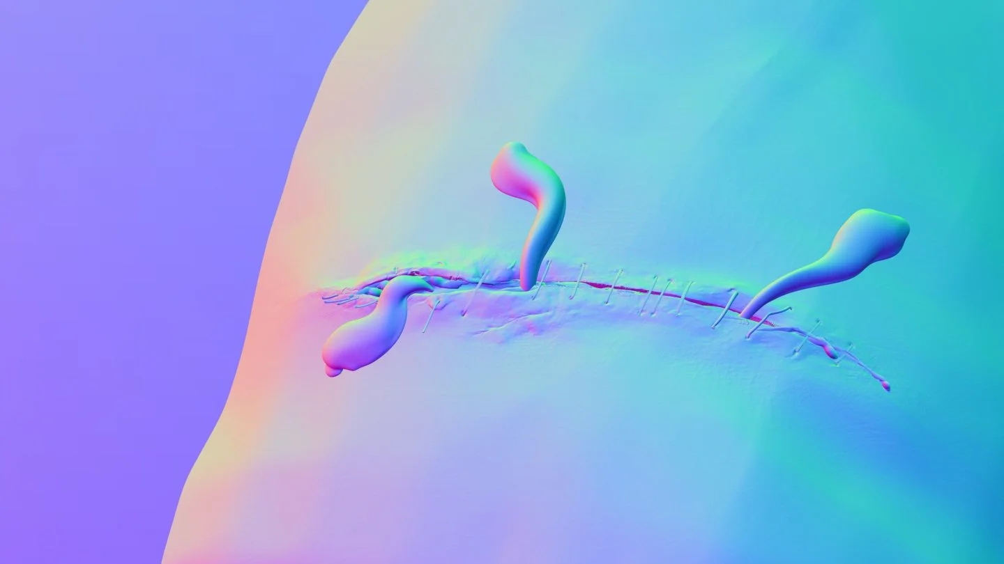 MST105_woundInPlace_v001-SDA_normals.jpg