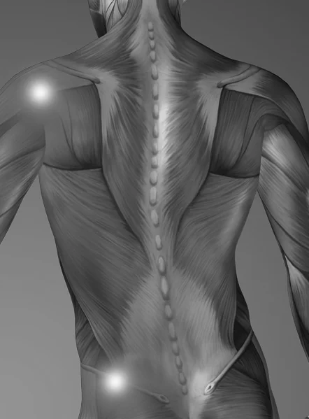 Surprising factors that could be causing your back pain