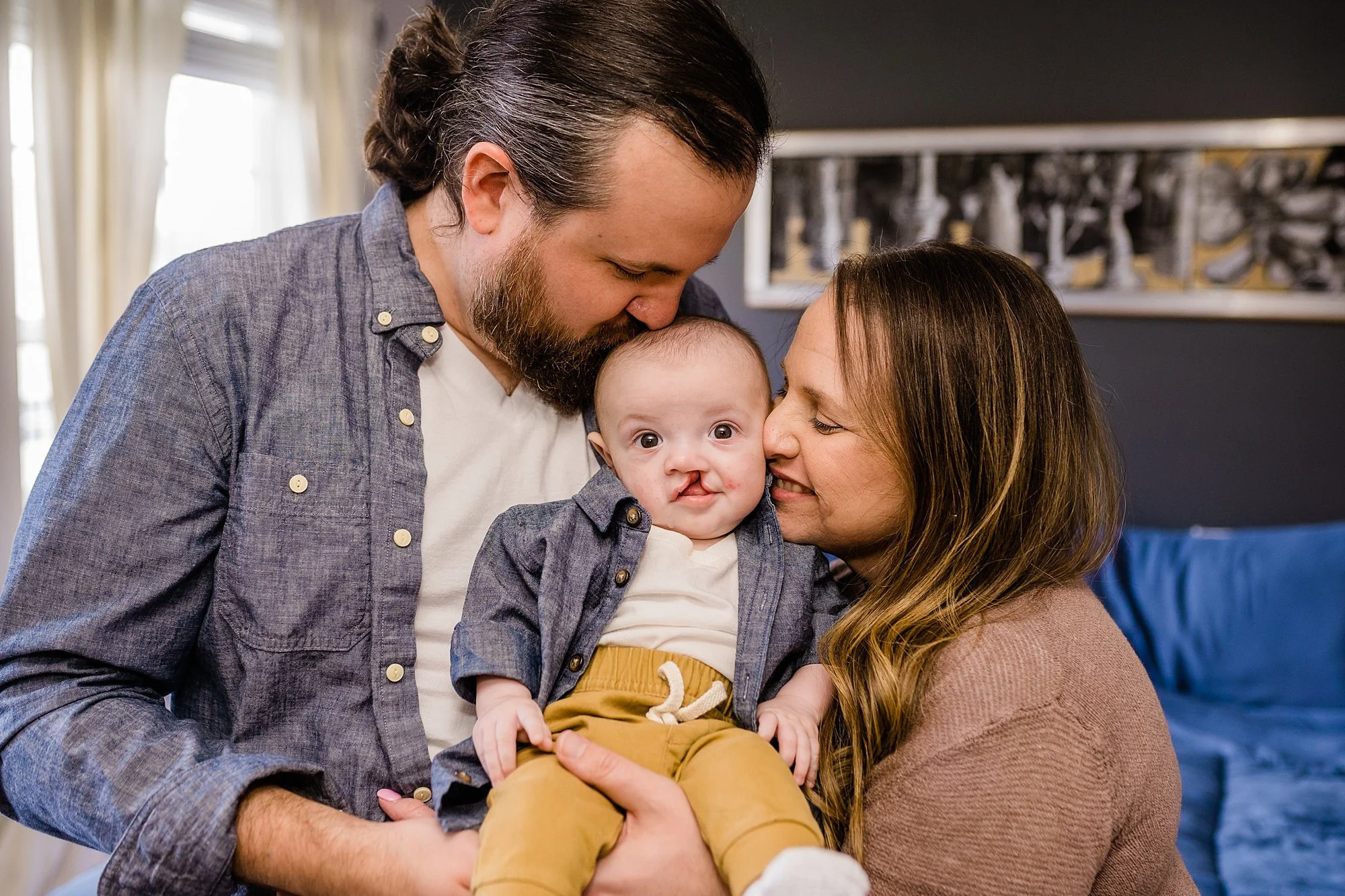 Baby Emmett | Cleft Cutie Newborn Photos | Marietta, PA