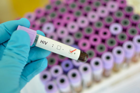  Combining an experimental vaccine with an innate immune stimulant may help lead to viral remission in people living with HIV. (stock image) Credit: © jarun011 / Fotolia 
