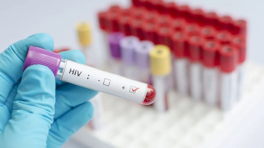 Hiv2.jpg