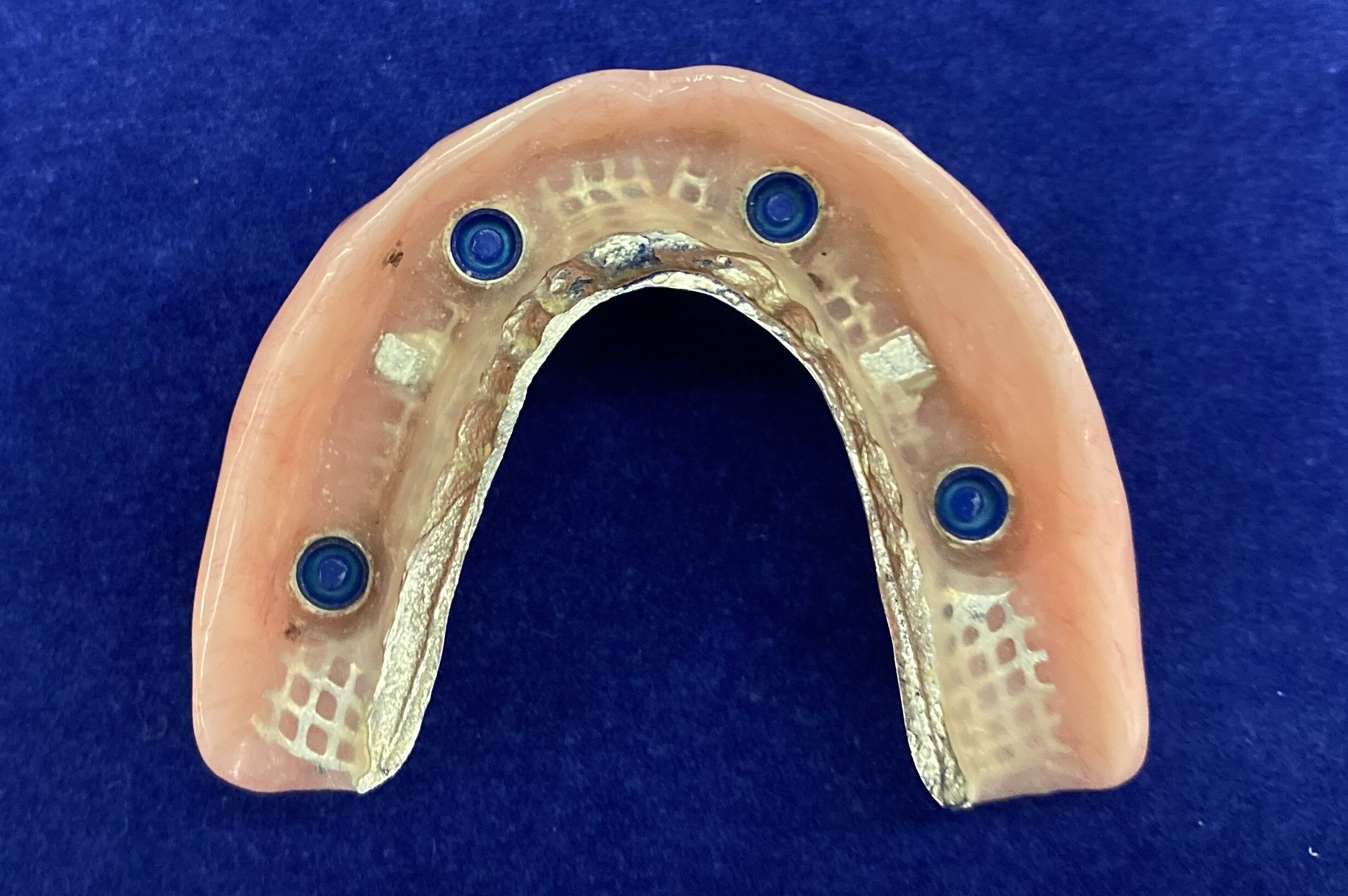 View of underside of denture
