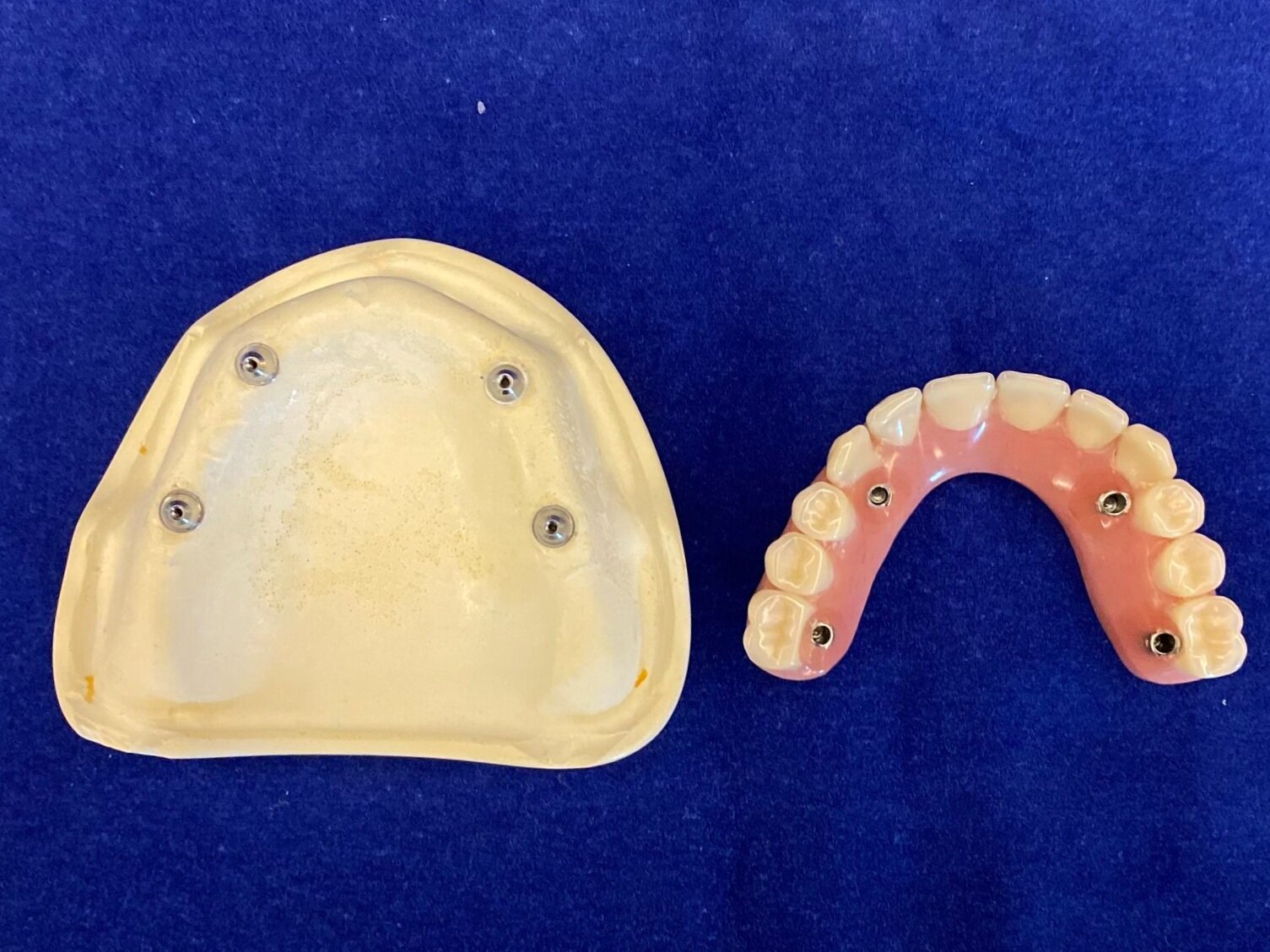 View of palate and denture when not attached