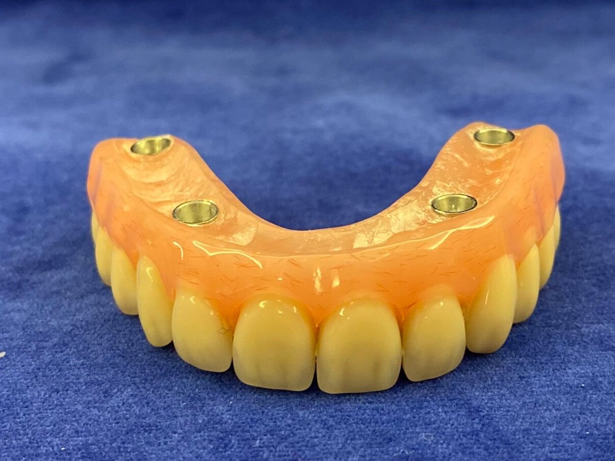 View of denture from front