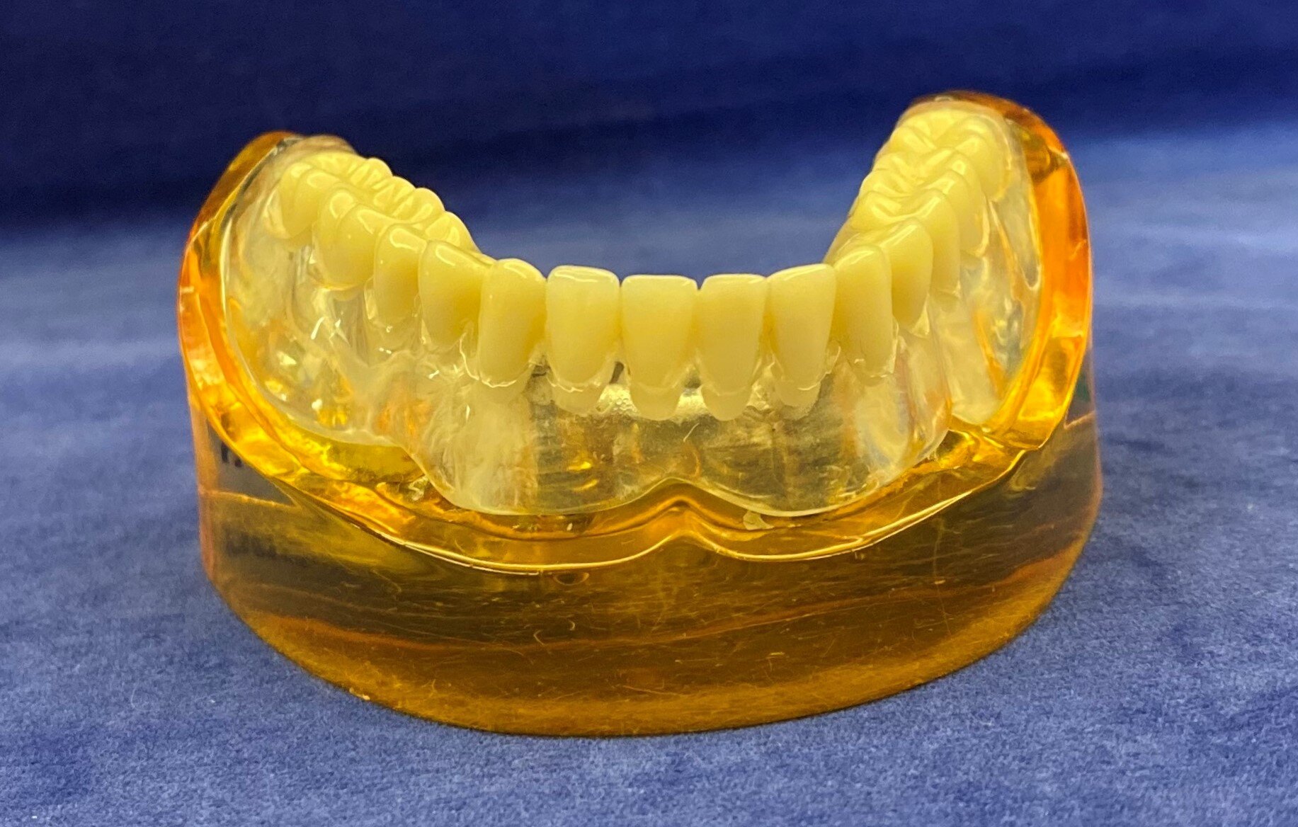 View of front of denture