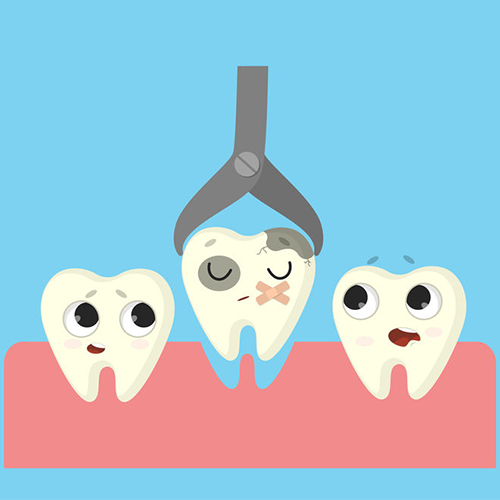 Dental Extractions — Brighter Smiles