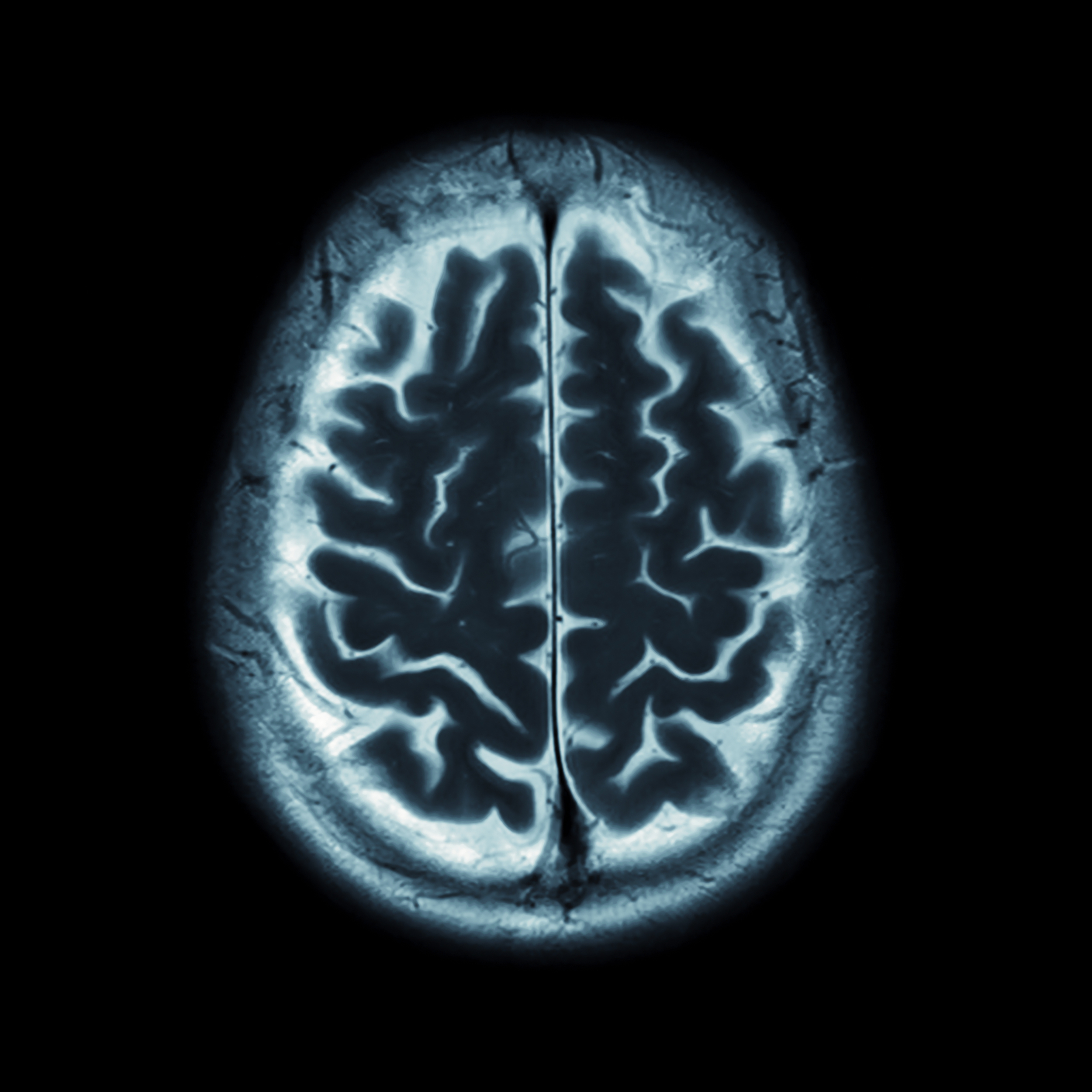 We made imaging sharper.