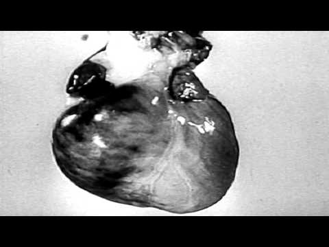 Brume - Help Me