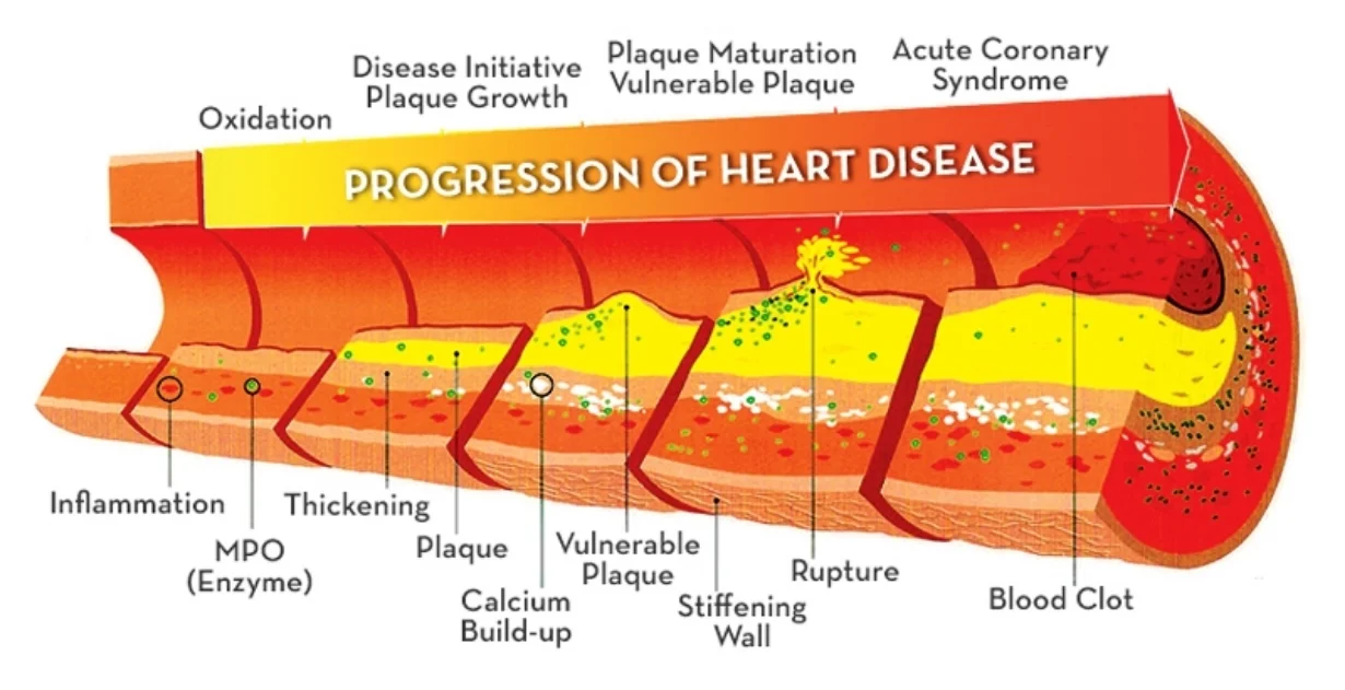 inflammation.jpg