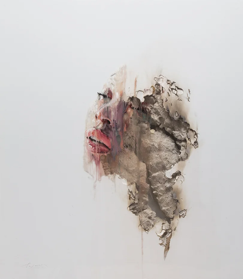 Wounds IV