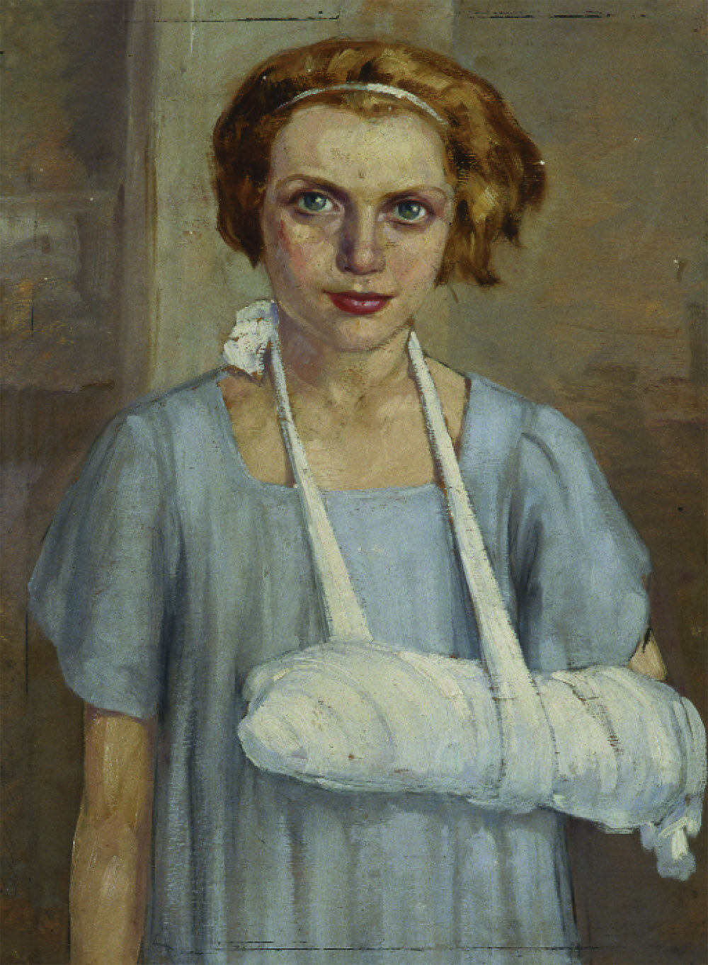 Girl with her arm in a cast (1935)