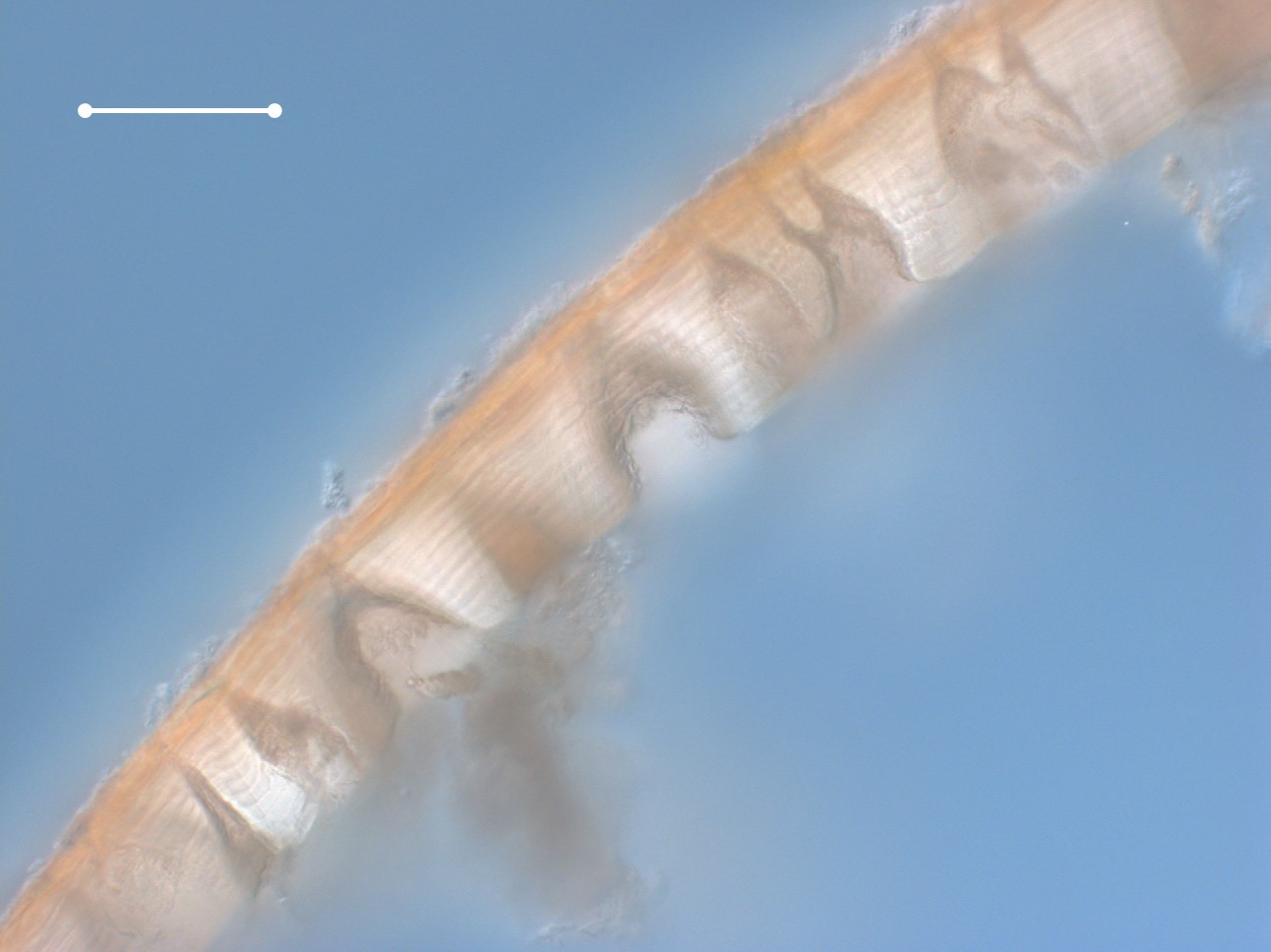  Cross-section of the cuticle of a large  Colossendeis  showing the many pores extending through the cuticle.&nbsp; Specimen viewed with differential interference contrast (DIC) optics at 20x.&nbsp; Scale bar = 100 microns. 