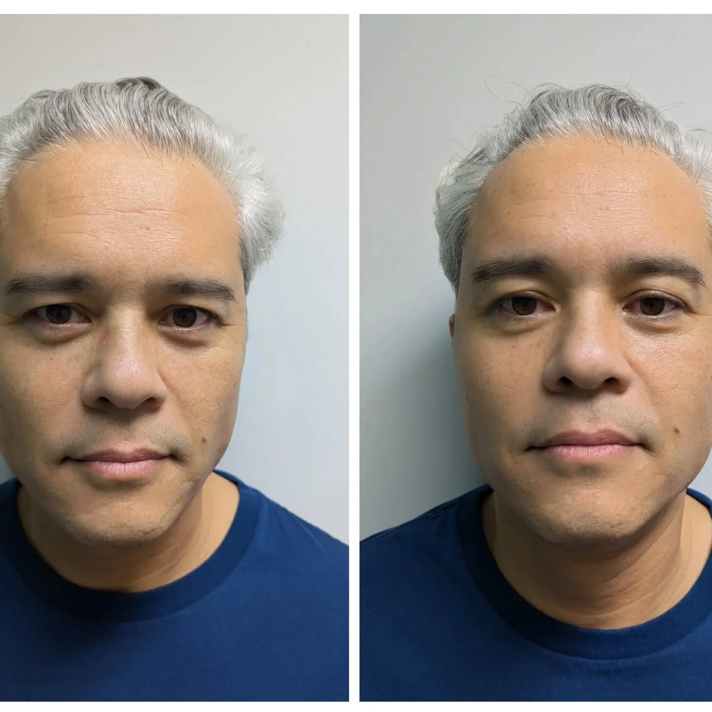 ✨Soft Gaze Activated✨

Lifted brows and forehead. 
Open and brighter eyes.
Relaxed cheeks, mouth and jaw.
Brighter, softer, even skin texture. 

When the nervous system settles, the face reflects it&mdash;less tension, more ease.

GLOW is facial-focu