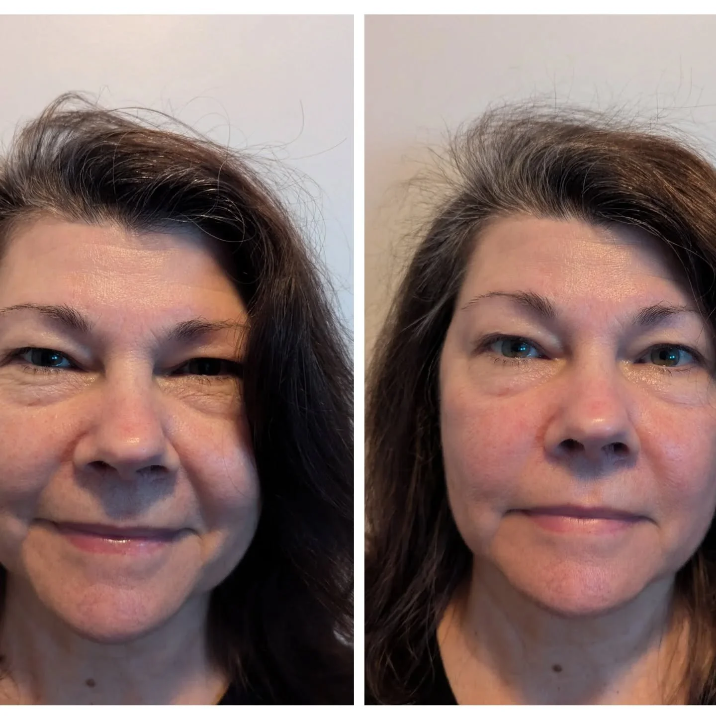 ✨ Youthful Glow Activated ✨

Brighter eyes. 
Reduced puffiness. 
Youthful skin. 

As fluid is moved, stagnation is cleared- revealing a brighter, awakened face. 

GLOW is facial-focused bodywork, working with the muscles of the face, scalp, and neck.