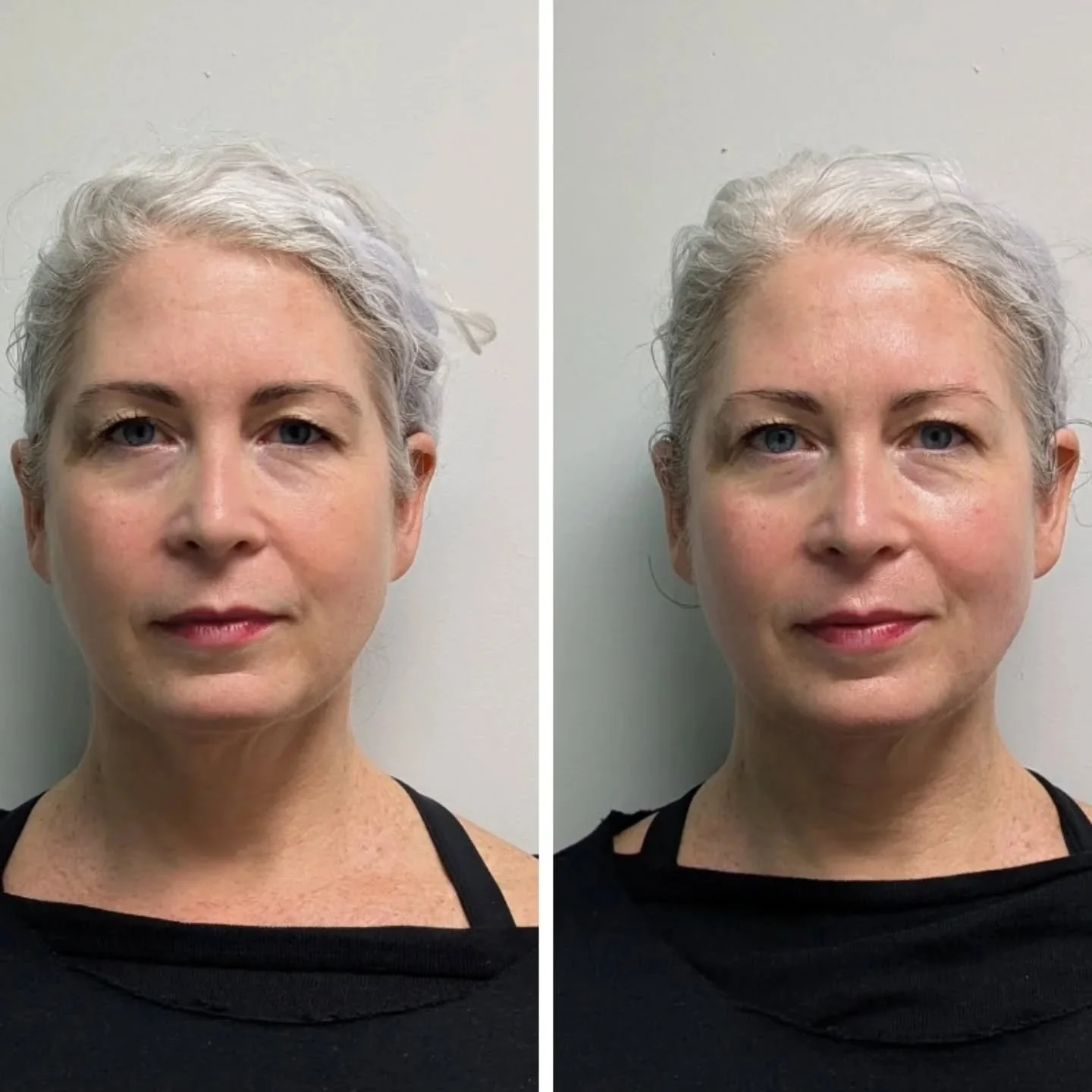 ✨ Relax, Breathe, GLOW✨

This one was such a treat for me. She's one of my besties and therefore also the unofficial model for Breathing Space Bodywork 🥰

GLOW works with the muscles of the face to release tension patterns and support circulation &m