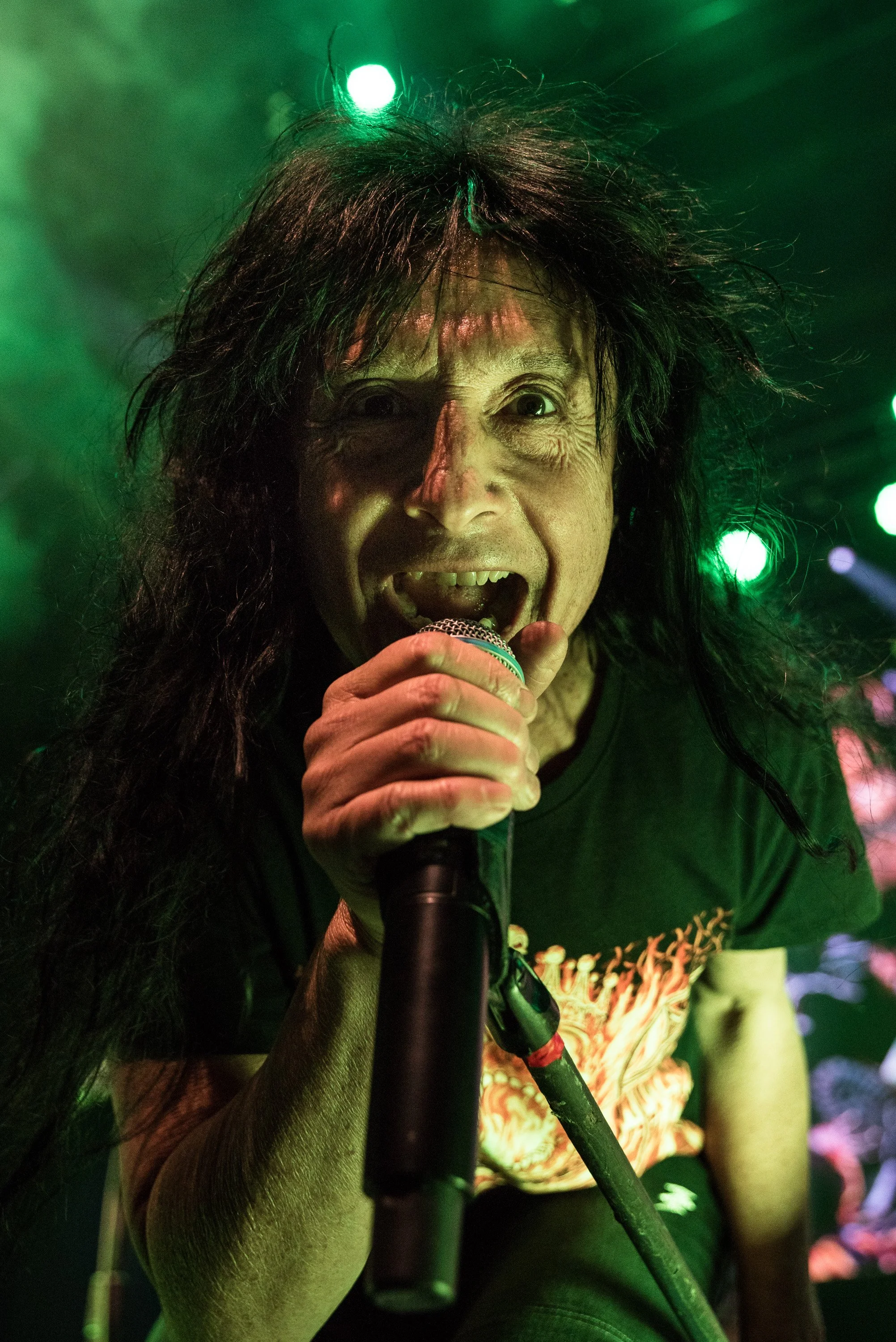 Anthrax